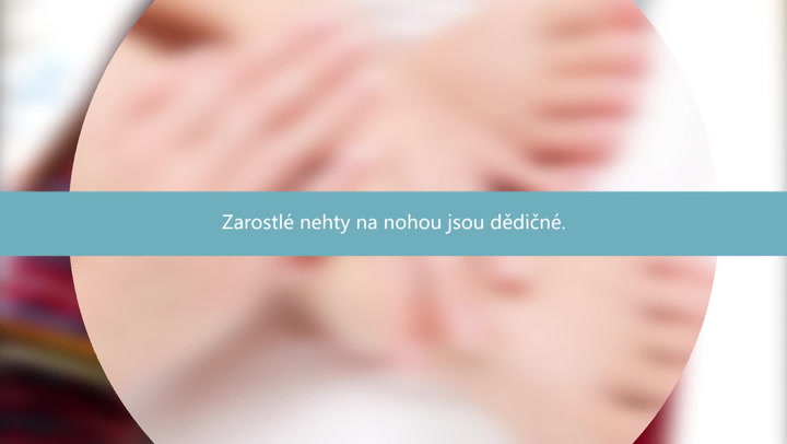 Zarůstající nehty na nohou jsou dědičné aneb 10 faktů o lidském těle!