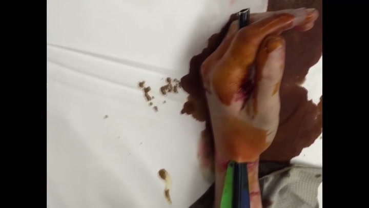 BRUTÁLNÍ VIDEO: Chlapík si prostřelil ruku šípem, doktor si jeho vytahování točil na mobil