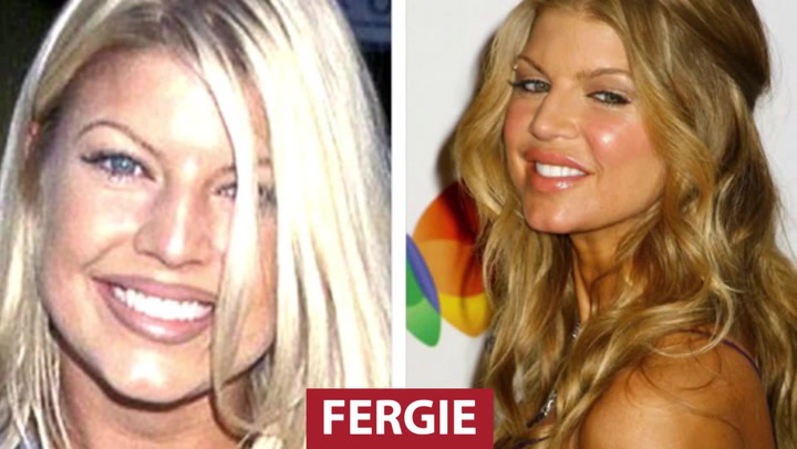 Jak ODPORNÉ! Celebrity, které prodělaly plastické operace k nepoznání!