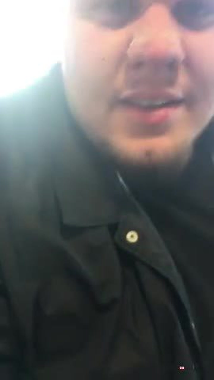 Nejodpornější video týdne. Neuvěříte, co raší tomuhle klukovi na nose!