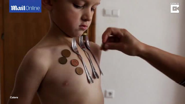 Neuvěřitelná hříčka přírody. Tenhle klučina má schopnosti jako Magneto z X-Men!