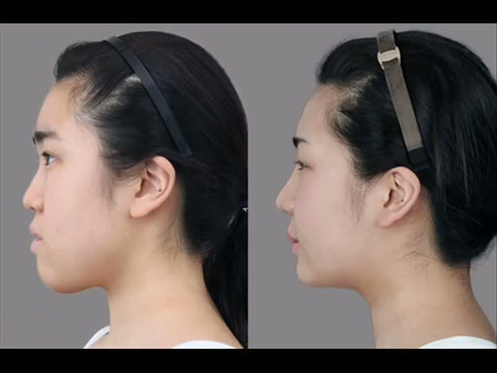 Korejští plastičtí chirurgové dokážou zázraky. Tohle video je jasný důkaz