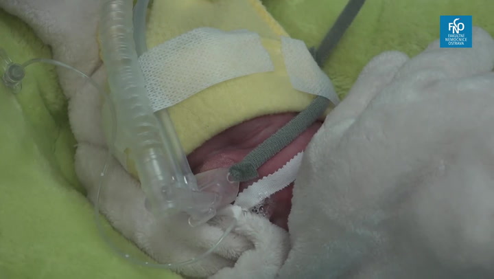 V Ostravě se narodila trojčata: Roztomilá miminka jsou zdravá, manželé se radují