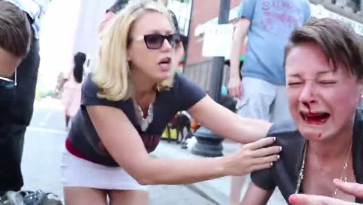 OTŘESNÝ ÚTOK PITBULTERIÉRA NA MALÉHO PSA! Video není vhodné pro slabší povahy!