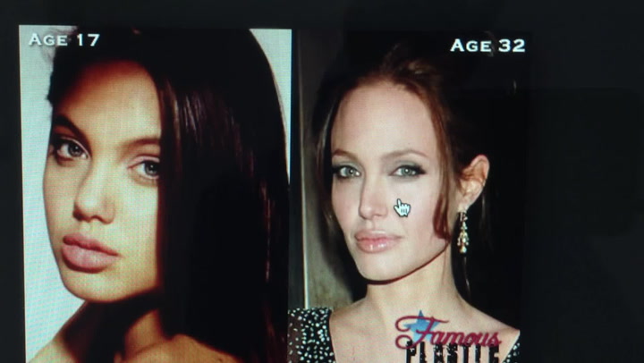 Rozbor plastik Angeliny Jolie: Z čeho měla slavná kráska mindráčky?