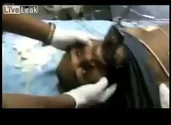 Co se stane, když spolknete mobil? Prožijete tohle peklo!