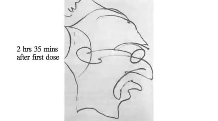 Jak umělec maloval portrét po požití LSD? Po dvou hodinách byly kresby děsivé