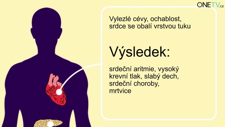Nepijte pivo každý den: Ohrožujete svoje zdraví!
