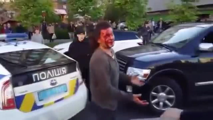 Bývalý boxer se střetl s policisty během běžné silniční kontroly! Byla z toho krvavá řež